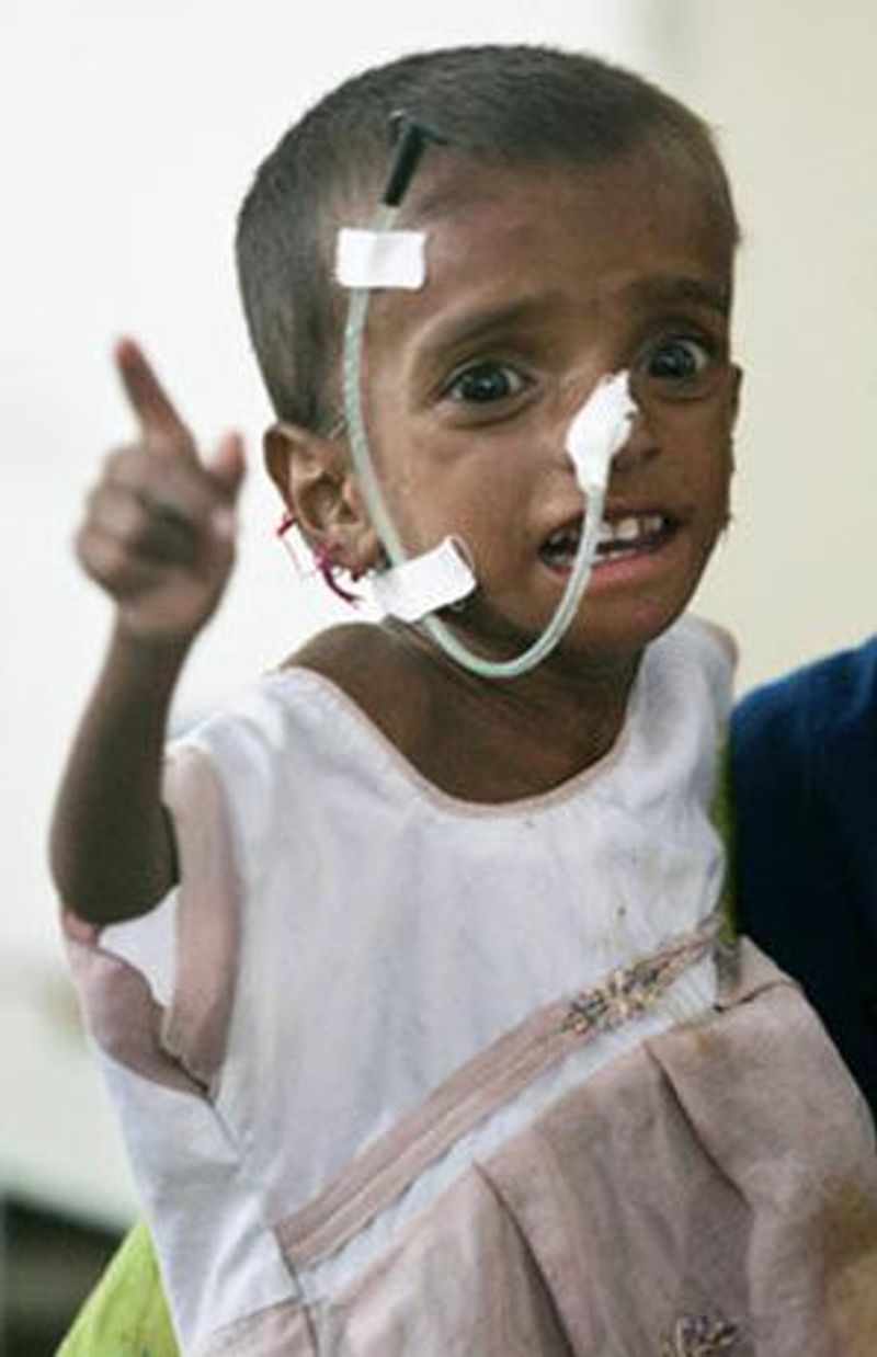 Shocking photos revealing hungry children in Pakistan