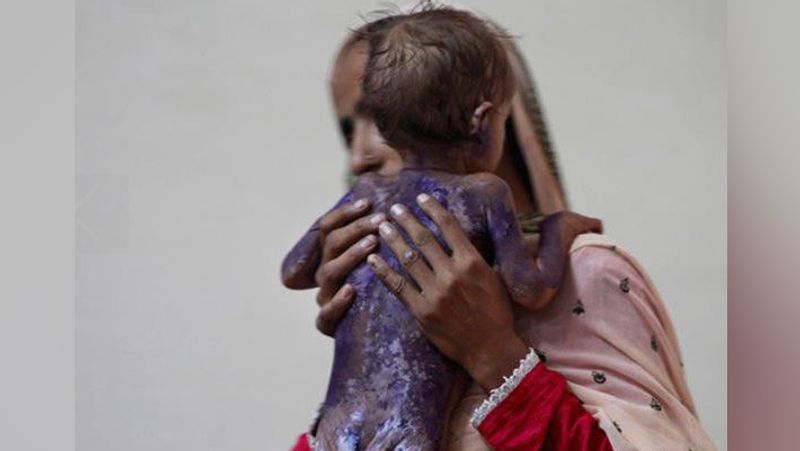 Shocking photos revealing hungry children in Pakistan