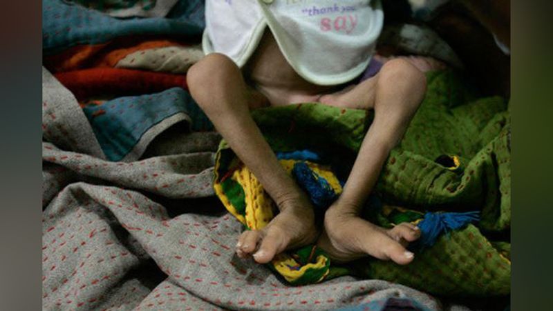Shocking photos revealing hungry children in Pakistan