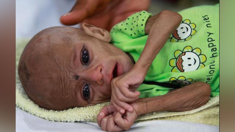 Shocking photos revealing hungry children in Pakistan