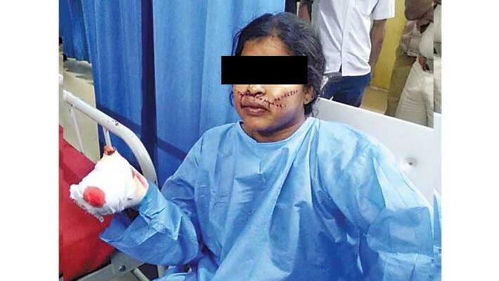 Attack On ex Minister HY Meti CD Case Accused Attack On ex Minister HY Meti CD Case Accused