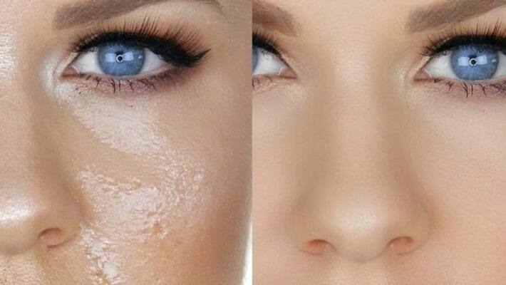 try this at home to fight oily skin try this at home to fight oily skin