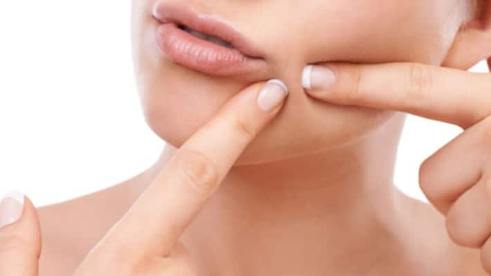 food avoid for pimples food avoid for pimples