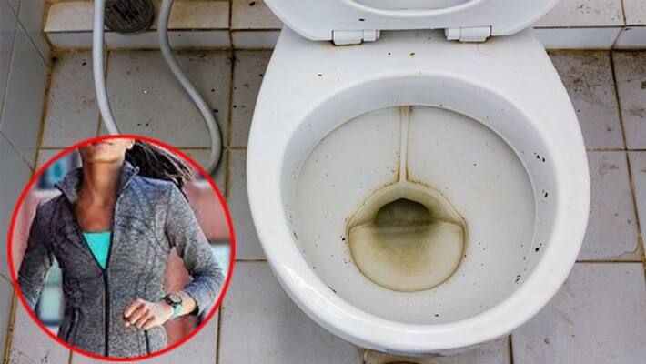 Fitness bands are 8 times dirtier than toilet seats Fitness bands are 8 times dirtier than toilet seats