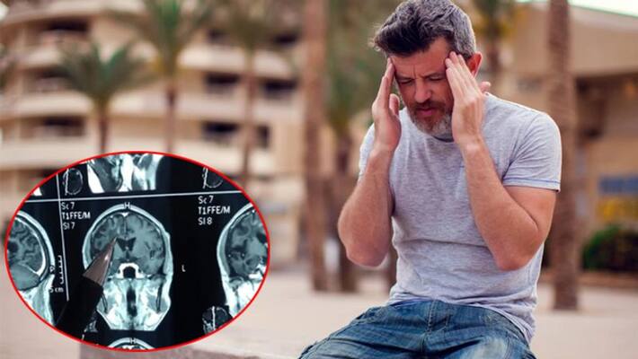 Long worm living in brain of Chinese man for 30 years Long worm living in brain of Chinese man for 30 years