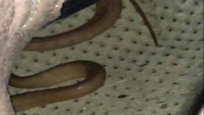 Creepy creatures were hidden in shoes as death, know what happened then Creepy creatures were hidden in shoes as death, know what happened then