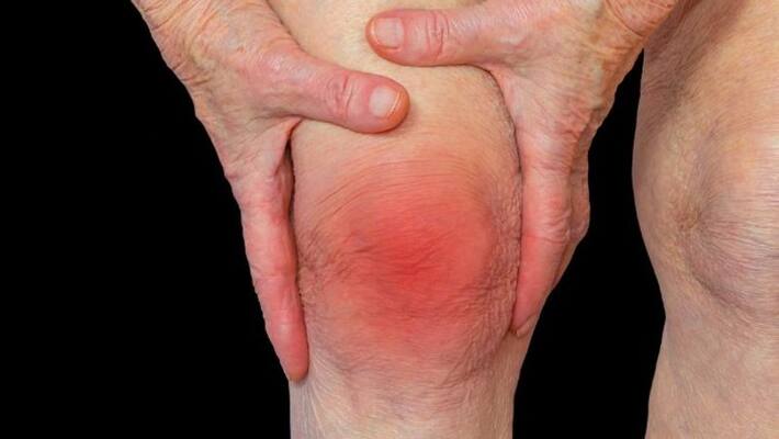 Free arthritis screening camp in Bengaluru on September 19-dnm Free arthritis screening camp in Bengaluru on September 19-dnm
