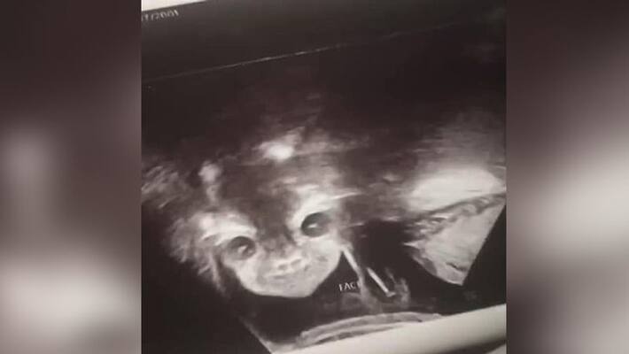 17 year old mother shocked watching devil face in ultrasound 17 year old mother shocked watching devil face in ultrasound