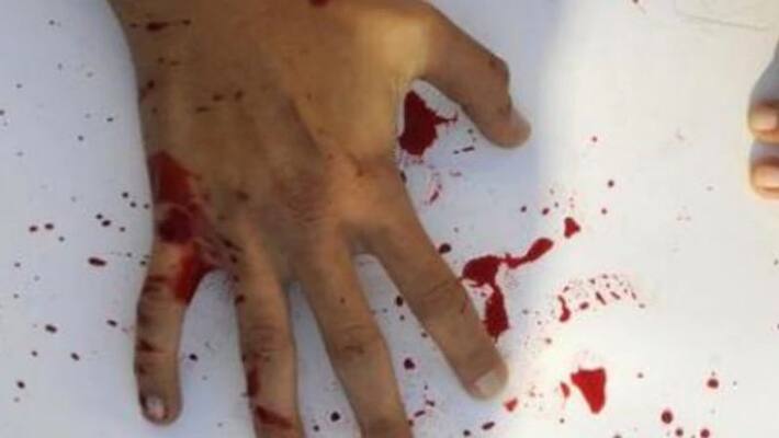 unknown persons attacked on trs leader ambati venkanna in warangal rural district unknown persons attacked on trs leader ambati venkanna in warangal rural district