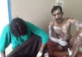 Rape accused tried to burn himself, policemen saved him
