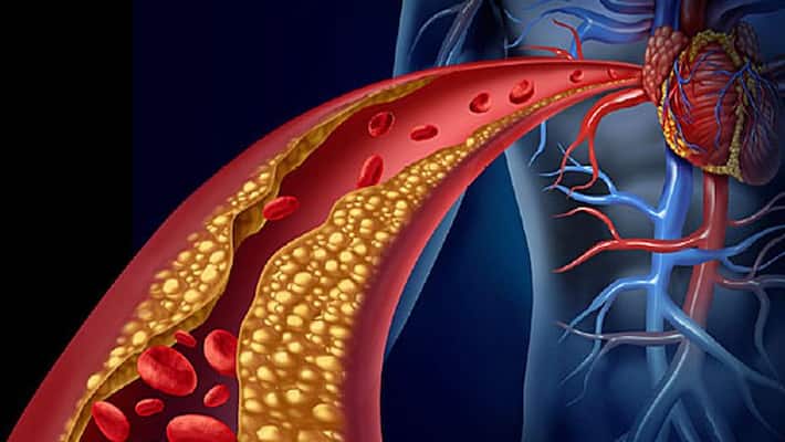 Natural Ways to Lower Your Cholesterol Levels Natural Ways to Lower Your Cholesterol Levels