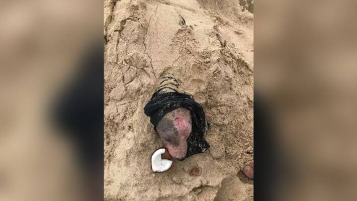 Owner buried dog alive after he got skin disease Owner buried dog alive after he got skin disease