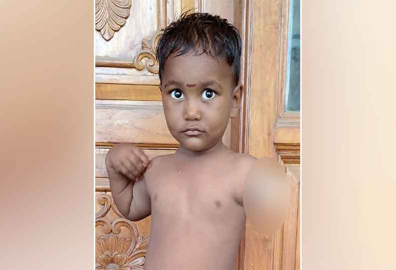 a father seeks government's help for his son's operation a father seeks government's help for his son's operation