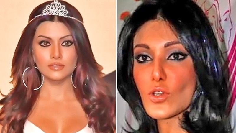 Bigg Boss Contestant Koena Mitra Surgery went Wrong