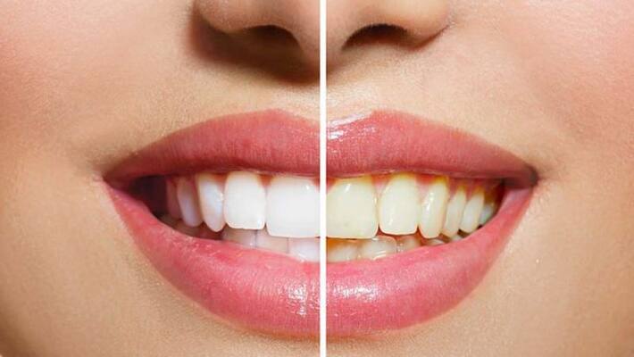 how to clean our tooth how to clean our tooth