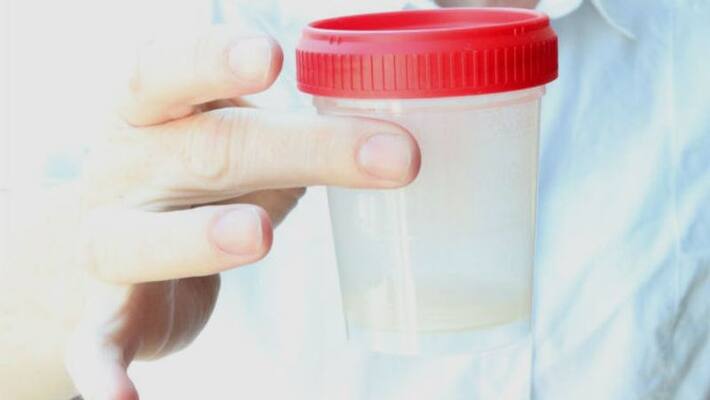 sperm count can be decreased by mental stress sperm count can be decreased by mental stress