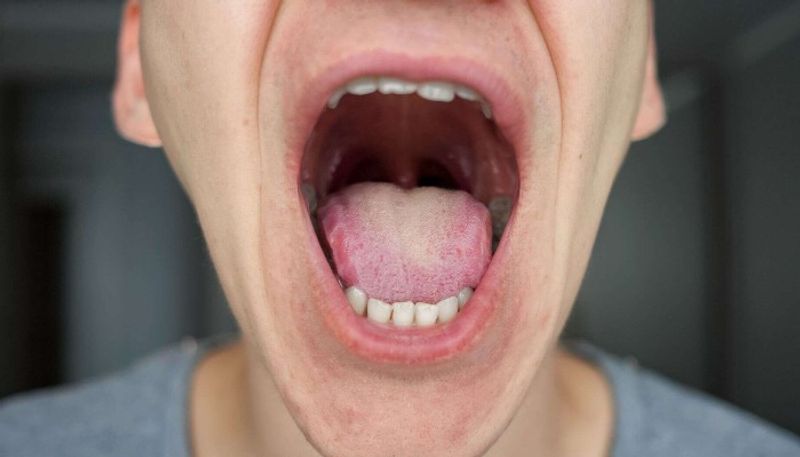 How Tongue color says about your health