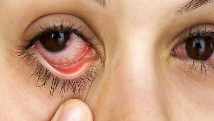 Macular degeneration may be dangerous for you Macular degeneration may be dangerous for you