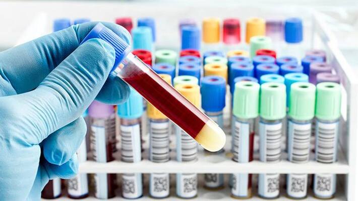 central government concern to corona virus test result delay and gave permission to 18 new labs for test central government concern to corona virus test result delay and gave permission to 18 new labs for test