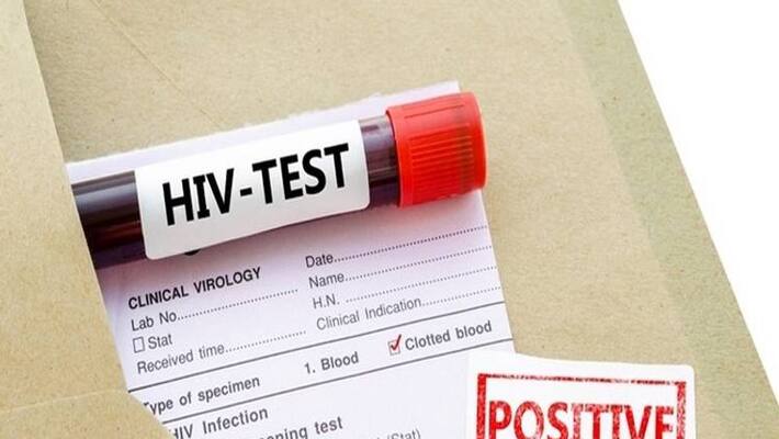 Hiv / Aids boom in Mizoram.. Authorities in worry Hiv / Aids boom in Mizoram.. Authorities in worry