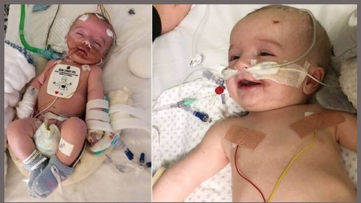 Baby boy defies doctors by waking from 5-day coma and smiling at dad Baby boy defies doctors by waking from 5-day coma and smiling at dad