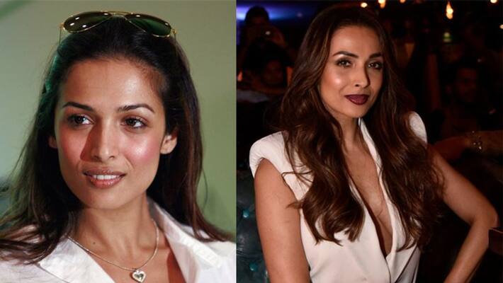 malaika arora talk about dark skin and working after 40 days of delivery malaika arora talk about dark skin and working after 40 days of delivery