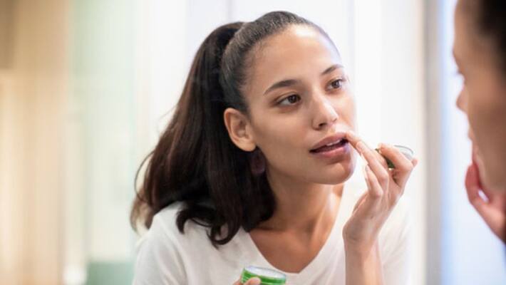 Take care of your Cracked lips easily at home Take care of your Cracked lips easily at home
