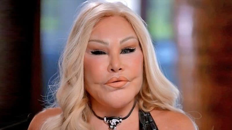 These women's plastic surgery gone wrong