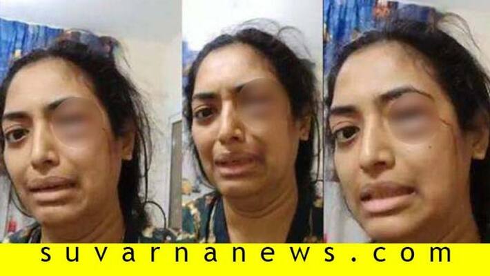 Bengaluru Woman in UAE Alleges Domestic Abuse Seeks Help on Twitter Bengaluru Woman in UAE Alleges Domestic Abuse Seeks Help on Twitter