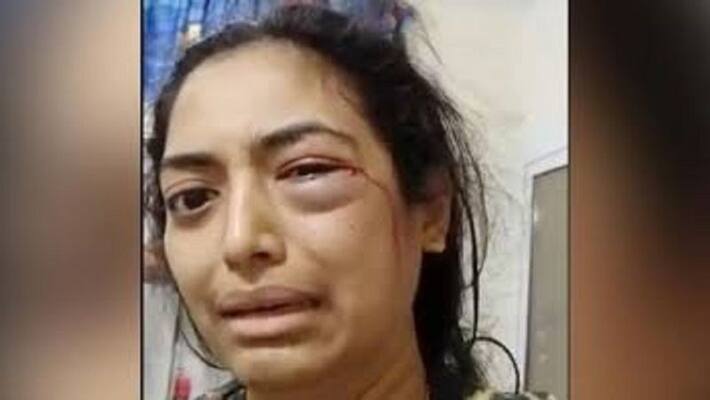Husband did so much abuse abroad, woman sought help on Twitter by posting video Husband did so much abuse abroad, woman sought help on Twitter by posting video
