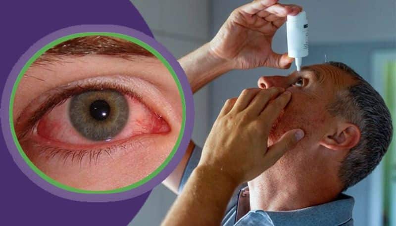 This season viral infections of the eye Conjunctivitis and its early symptoms BDD