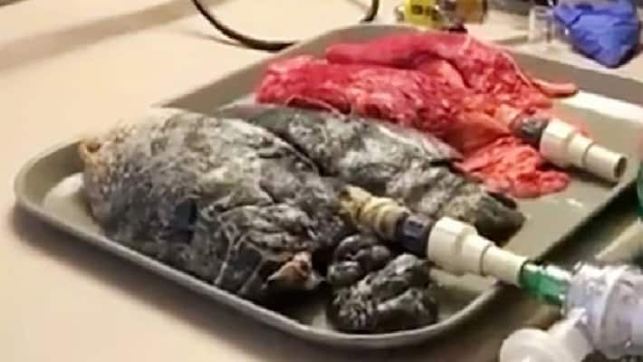 Transplant doctor rejects damaged donated lungs from chain smoker Transplant doctor rejects damaged donated lungs from chain smoker