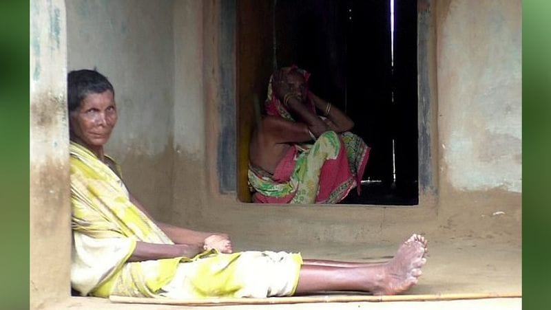 Indian woman called witch for being born with 19 toes and 12 fingers