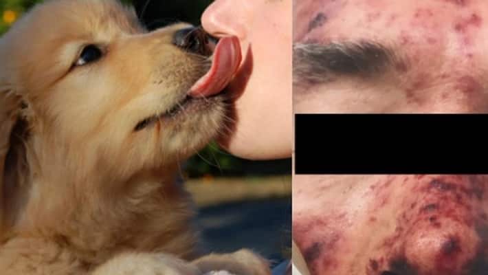 63 old man died due to multiple organ failure after pet dog licked his face 63 old man died due to multiple organ failure after pet dog licked his face