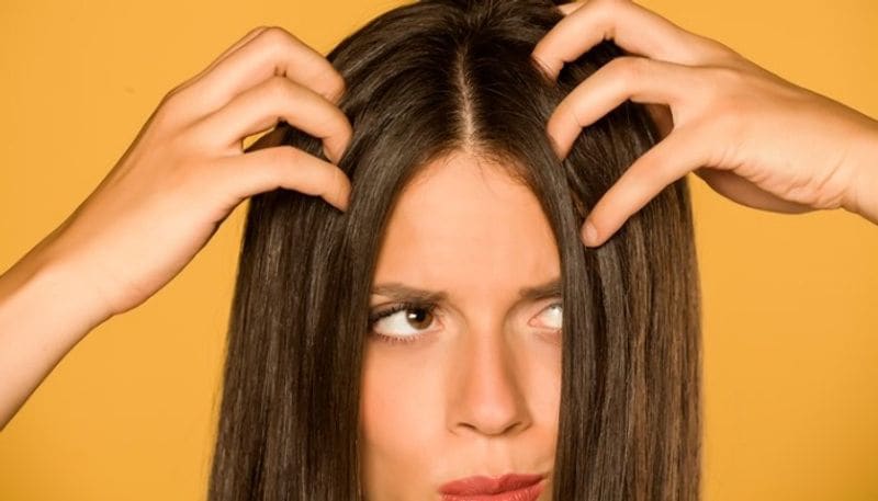 If you wish to get rid of oily hair, then bring these kitchen ingredients to your rescue. Read on to know more about them.