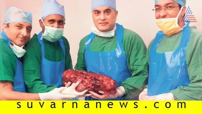 Doctors remove world largest kidney weighing 7 4 kg at Delhi Hospital Doctors remove world largest kidney weighing 7 4 kg at Delhi Hospital