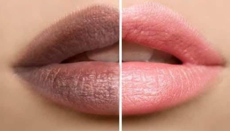 how you can treat dark lips