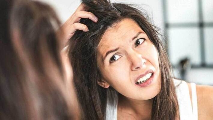 Remove dandruff by traditional ways Remove dandruff by traditional ways