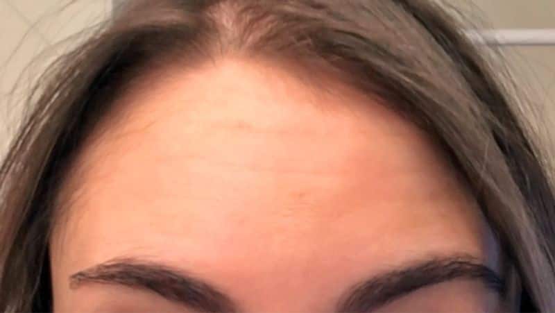 Forehead lines will reveal the secret of your future