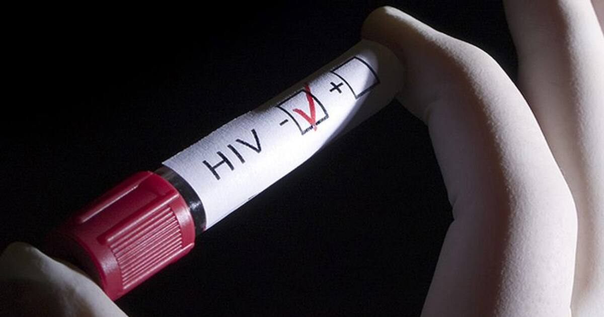 ചുംബനത്തിലൂടെ എയ്ഡ്‌സ് പകരുമോ..? dr rajesh video about hiv Transmitted Through Kissing