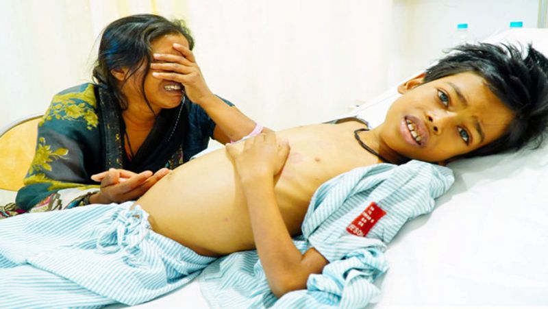 7 Year Old boy Has Been Reduced To Bones Due To Cancer in jaipur