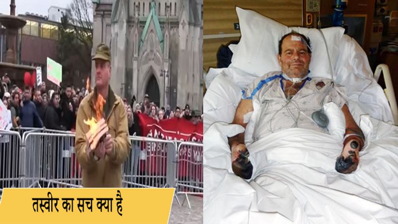 viral post of burning Quran this image of a man suffering from bubonic plague misleading people