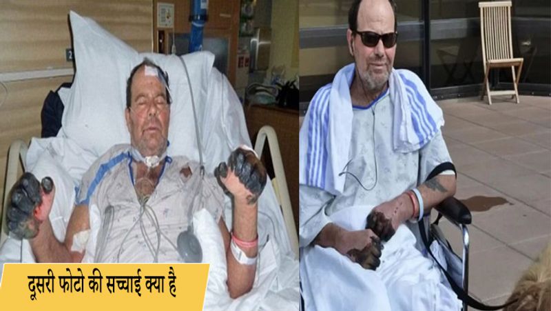 viral post of burning Quran this image of a man suffering from bubonic plague misleading people
