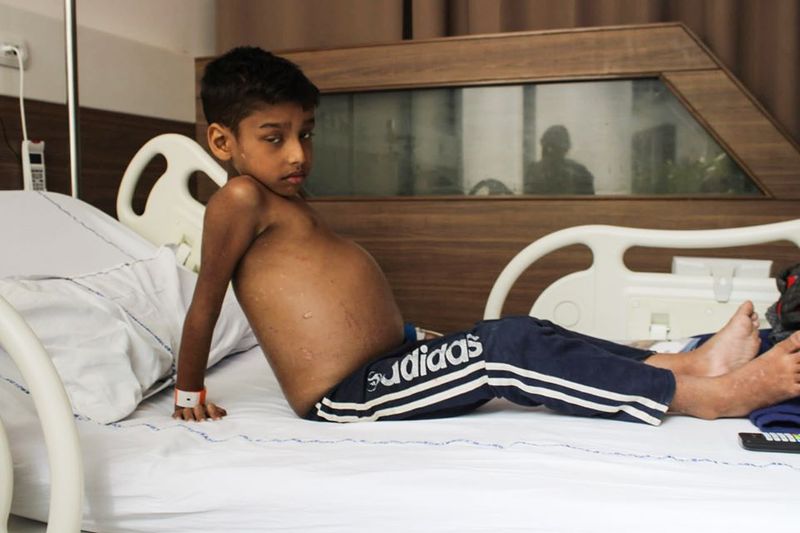 kolkata Parents Are Ready To Go Homeless To Save Their Son from Liver disease