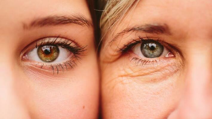 Get rid of early aging skin problems easily Get rid of early aging skin problems easily