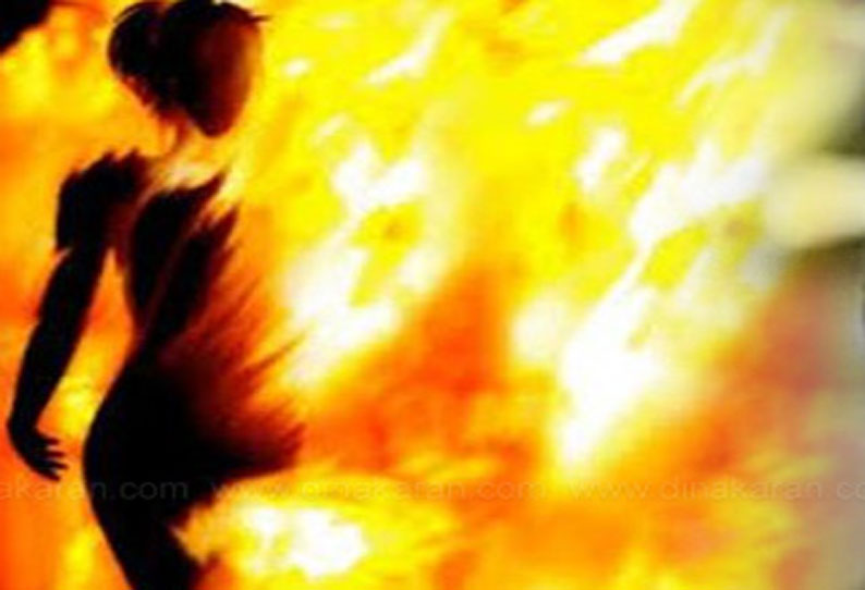 Rape Survivor Set On Fire On Way To Court In UP's Unnao Rape Survivor Set On Fire On Way To Court In UP's Unnao