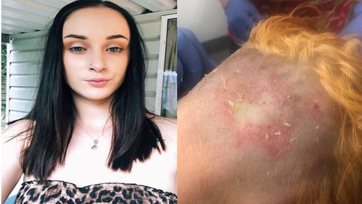 The girl wanted to get black hair golden, fashion turned into a dreadful situation KPI The girl wanted to get black hair golden, fashion turned into a dreadful situation KPI