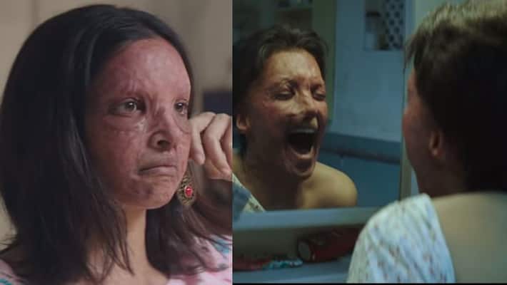 Chhapaak Trailer: Deepika Padukone as acid attack survivor Laxmi Agarwal leaves viewers speechless Chhapaak Trailer: Deepika Padukone as acid attack survivor Laxmi Agarwal leaves viewers speechless