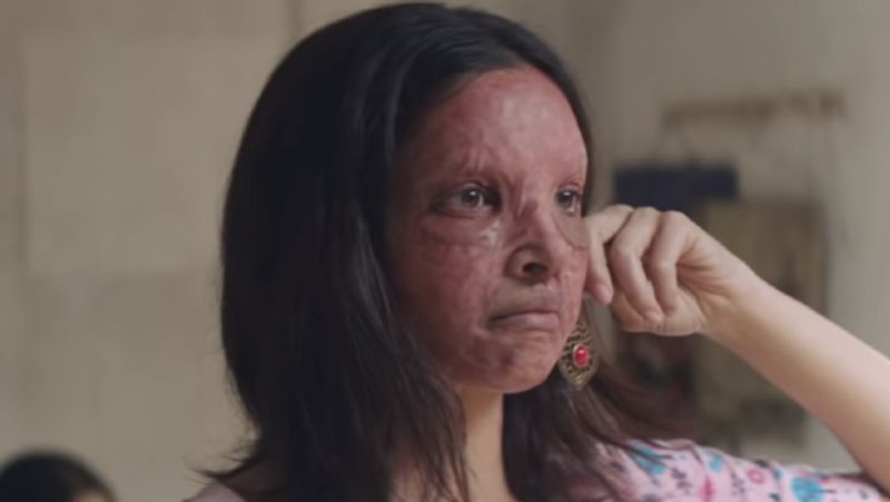 Chhapaak Movie Trailer Deepika padukone look takes Prosthetic Makeup for Become Malti KPY