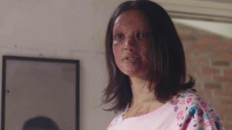 Chhapaak Movie Trailer Deepika padukone look takes Prosthetic Makeup for Become Malti KPY